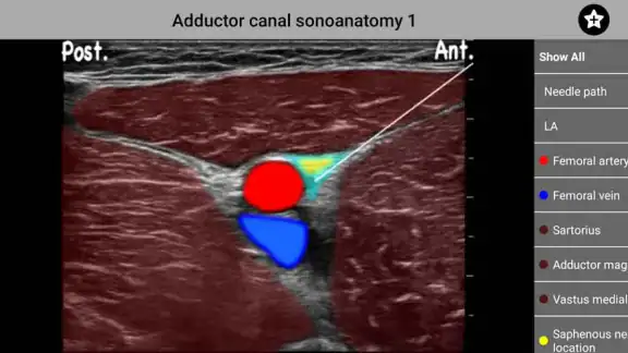 AnSo Anaesthesia Sonoanatomy