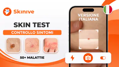 Scanner Pelle IA: Salute & Nei
