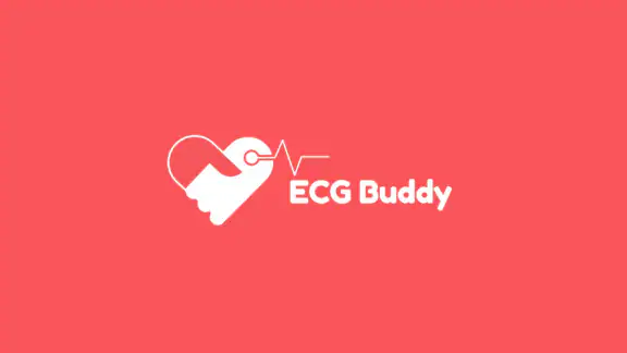 ECG Buddy | ECG Analysis AI