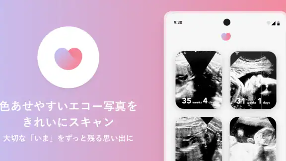 エコー写真　スキャンして簡単整理！