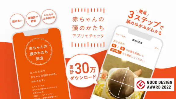 赤ちゃんの頭のかたち測定