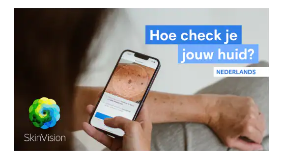 SkinVision - herken huidkanker