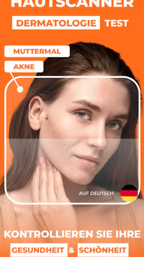 Haut Scanner: KI hautarzt app screenshot