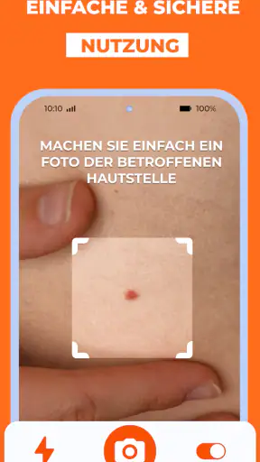 Haut Scanner: KI hautarzt app screenshot