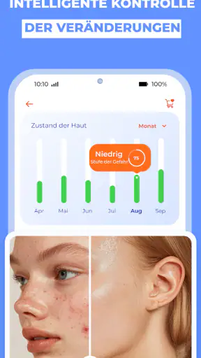 Haut Scanner: KI hautarzt app screenshot