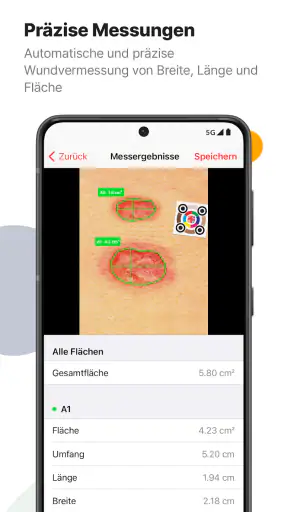imitoWound - Wunddokumentation screenshot
