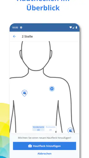 SkinVision screenshot