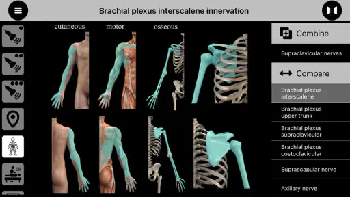 AnSo Anaesthesia Sonoanatomy screenshot 10