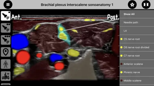 AnSo Anaesthesia Sonoanatomy screenshot 9