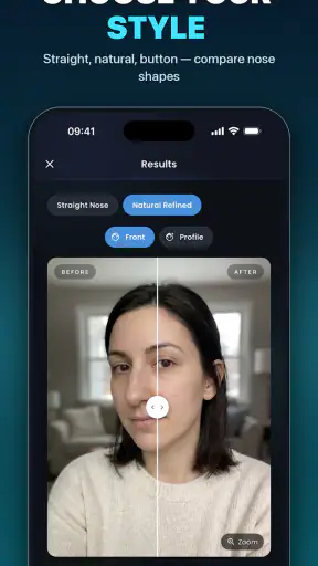 Nose Job - Plastic Surgery AI screenshot 11