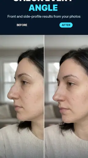 Nose Job - Plastic Surgery AI screenshot 9