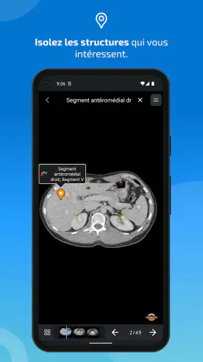 IMAIOS e-Anatomy screenshot