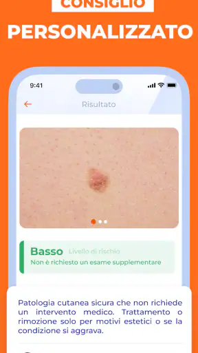 Scanner Pelle IA: Salute & Nei screenshot 5