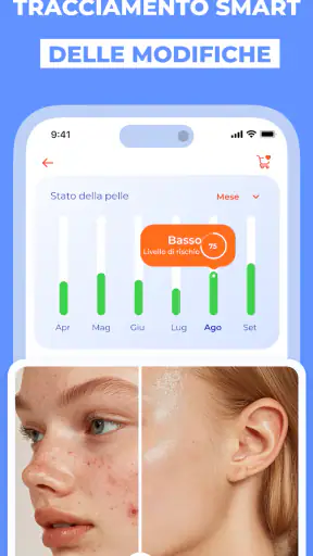 Scanner Pelle IA: Salute & Nei screenshot 6
