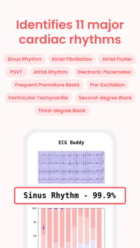 ECG Buddy | ECG Analysis AI screenshot 3