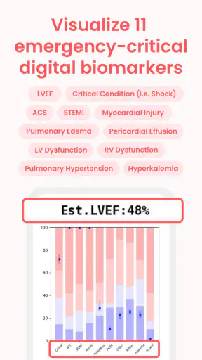 ECG Buddy | ECG Analysis AI screenshot 4