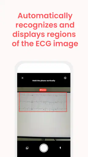 ECG Buddy | ECG Analysis AI screenshot 5