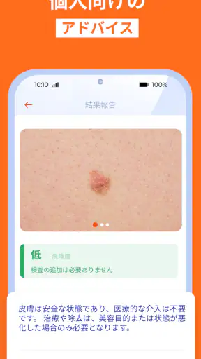 AI肌診断・肌スキャン: 健康・美容・UV指数・紫外線 screenshot 5
