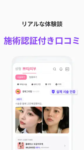 バビトーク − 韓国 整形 / 施術プラットフォーム screenshot